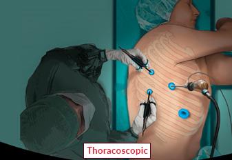 ArduinoProjectHub profile picture for @thoracic